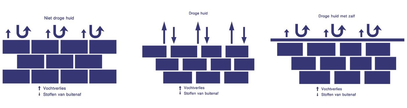 De huidbarrière